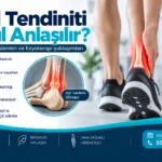 Aşil tendiniti belirtileri ve fizyoterapi değerlendirmesini gösteren ayak bileği anatomik görseli