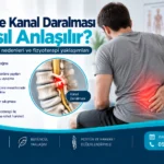 Belde Kanal Daralması Nasıl Anlaşılır? için anatomik görsel ve fizyoterapi değerlendirmesi