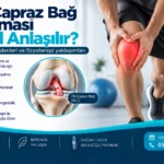 Ön Çapraz Bağ Kopması Nasıl Anlaşılır? için anatomik görsel ve fizyoterapi değerlendirmesi