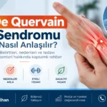 De Quervain sendromu – fizyoterapi değerlendirmesi ve anatomik bilgilendirme görseli