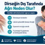 Dirseğin dış tarafında ağrı ve lateral tendon bölgesini gösteren anatomik fizyoterapi görseli